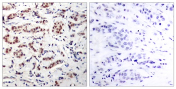 Stat5 (phospho Tyr694/699) rabbit pAb Antibody