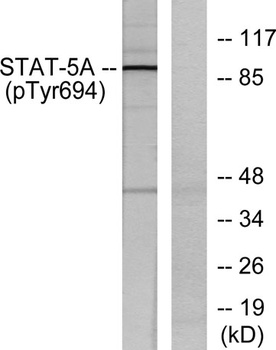 Stat5 (phospho Tyr694/699) rabbit pAb