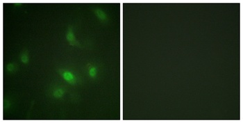 Stat5a/b (phospho-Ser726/731) antibody