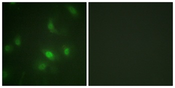 Stat5a/b (phospho Ser726/731) rabbit pAb