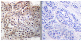 Stat5a/b (phospho Ser726/731) rabbit pAb