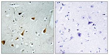 Stat6 rabbit pAb