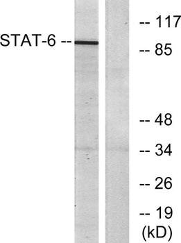 Stat6 antibody