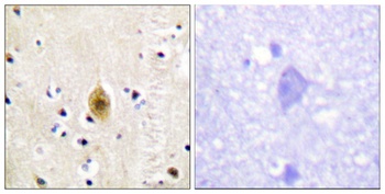 Krs-1/2 (phospho-Thr183) antibody