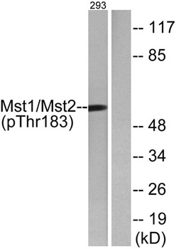 Krs-1/2 (phospho-Thr183) antibody