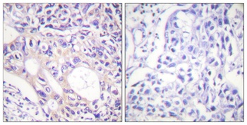 ARK-1 (phospho Thr288) rabbit pAb