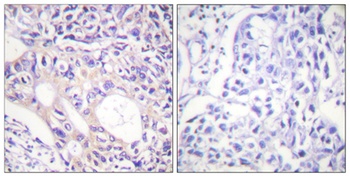 ARK-1 (phospho-Thr288) antibody