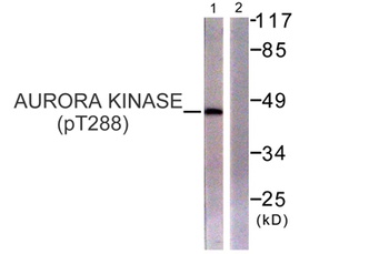 ARK-1 (phospho Thr288) rabbit pAb