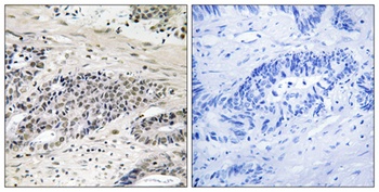 ARK-1 (phospho Ser342) rabbit pAb