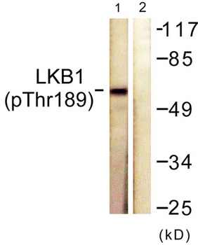 LKB1 (phospho Thr189) rabbit pAb