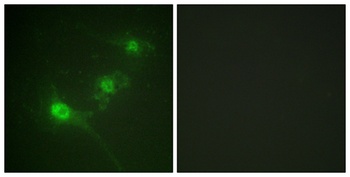 LKB1 (phospho-Ser428) antibody