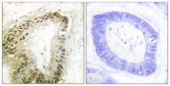 LKB1 (phospho-Ser428) antibody