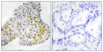 LKB1 rabbit pAb Antibody
