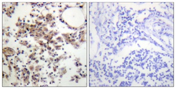 Syk (phospho Tyr323) rabbit pAb