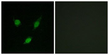 TACC1 rabbit pAb