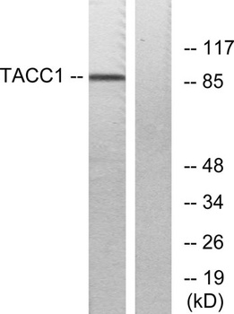 TACC1 rabbit pAb