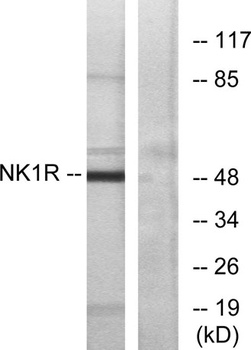 NK-1R antibody