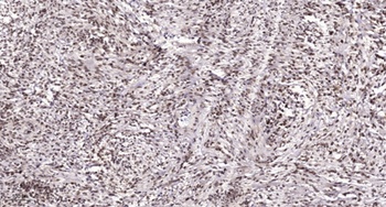 TAF II p135/p105 antibody