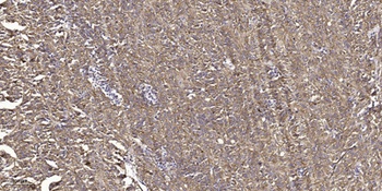 Tak1 (phospho-Thr184) antibody