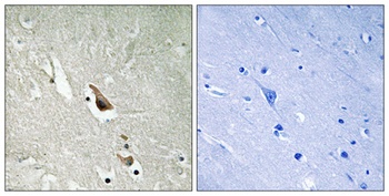 Tak1 (phospho Ser439) rabbit pAb