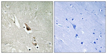 Tak1 (phospho-Ser439) antibody