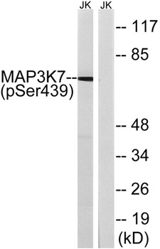 Tak1 (phospho-Ser439) antibody