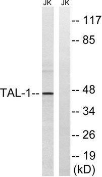 TAL1 antibody