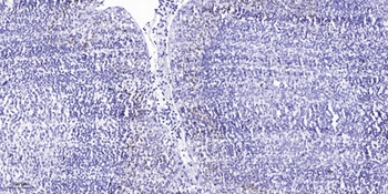 TAL1 antibody