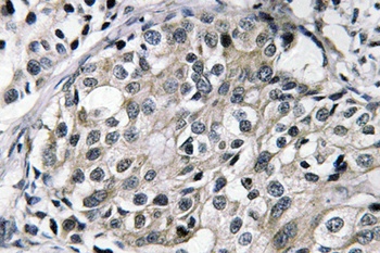 TAT rabbit pAb Antibody