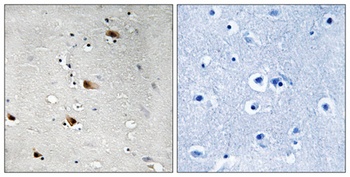 E2A (phospho Thr355) rabbit pAb