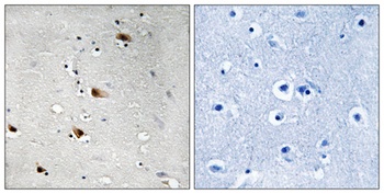 E2A (phospho-Thr355) antibody