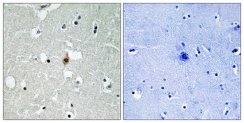 E2A rabbit pAb Antibody