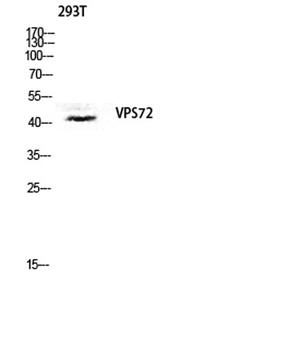 VPS72 rabbit pAb Antibody