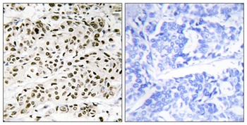 VPS72 rabbit pAb Antibody