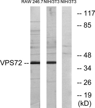 VPS72 rabbit pAb Antibody