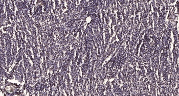 TDG antibody