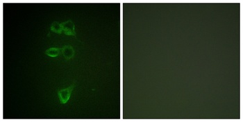 Tie-2 (phospho Tyr1108) rabbit pAb