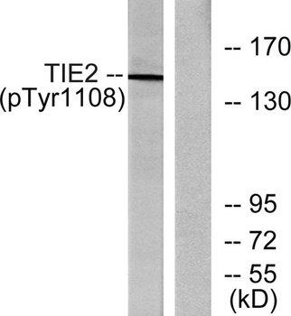 Tie-2 (phospho Tyr1108) rabbit pAb