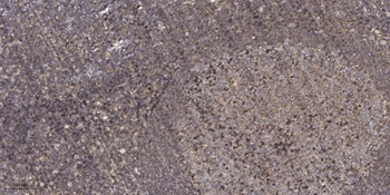 Tie-2 (phospho Tyr1108) rabbit pAb