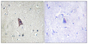 Tie-2 (phospho Tyr1102) rabbit pAb