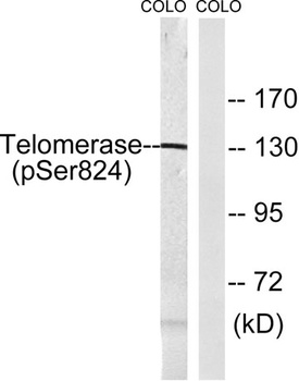 TERT (phospho Ser824) rabbit pAb