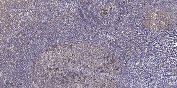 TERT (phospho Ser824) rabbit pAb