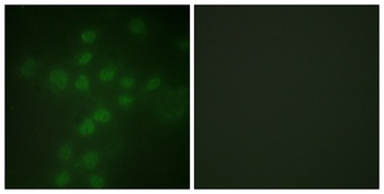 TERT (phospho-Ser227) antibody