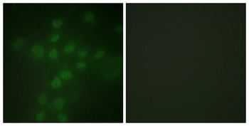 TERT (phospho Ser227) rabbit pAb