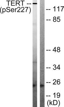 TERT (phospho Ser227) rabbit pAb