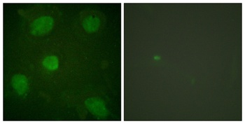 Hic-5 antibody