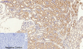 TGFβ RI (phospho Ser165) rabbit pAb
