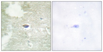 TGF beta RII (phospho-Ser225) antibody