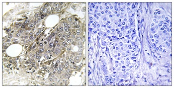 TGF beta RIII antibody