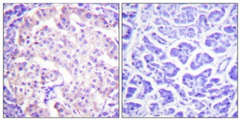 TH (phospho-Ser62) antibody